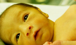 Гемолитическая желтуха у новорожденных