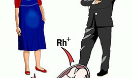 Резус-конфликт при беременности: симптомы у матери