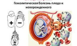 Что такое резус-конфликт плода