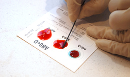 Анализ на резус-конфликт при беременности