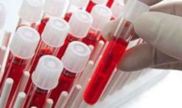 Иммуноглобулин при резус-конфликте